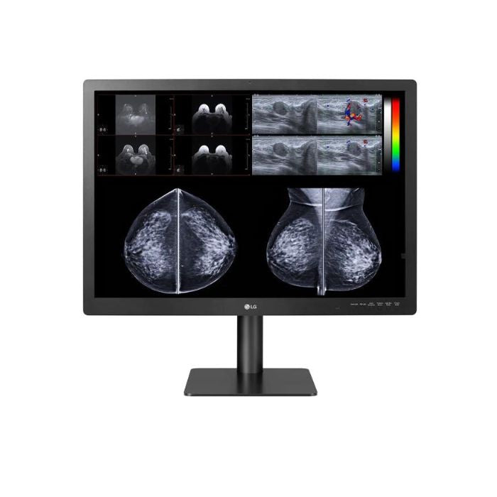 31HN713D-diagnostic-mammographie